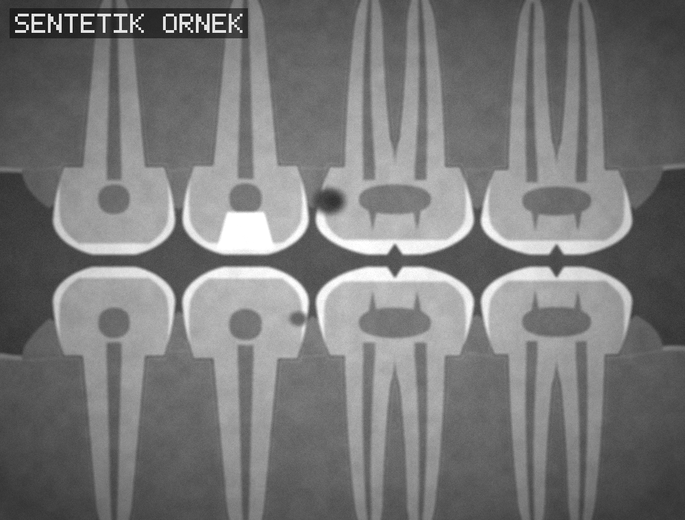 Bitewing örnek röntgen (sentetik)